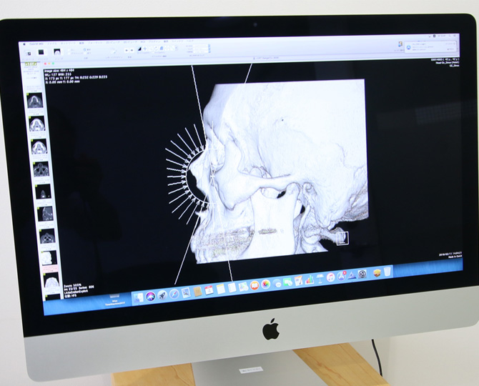 Osirix：画像解析ソフトCT、MRIなどの画像診断に用います